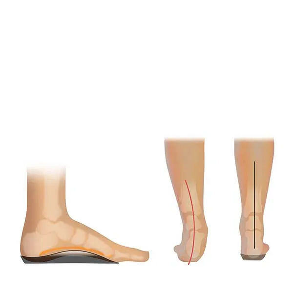 FOOTLOGICS CASUAL 3/4 ORTHOTIC